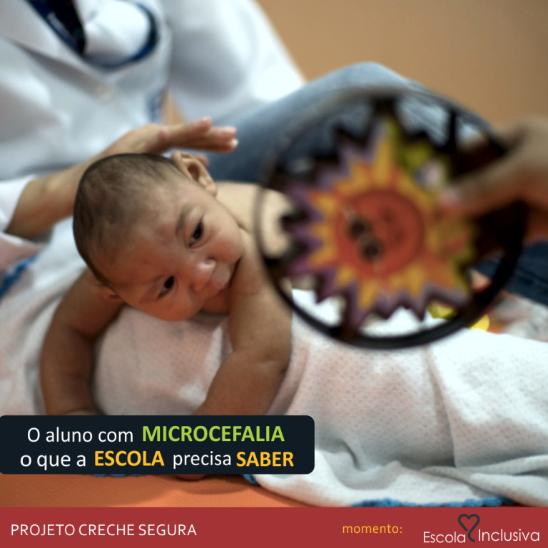 16 Recomendações Para Estimulação De Crianças Com Microcefalia Creche Segura 0867